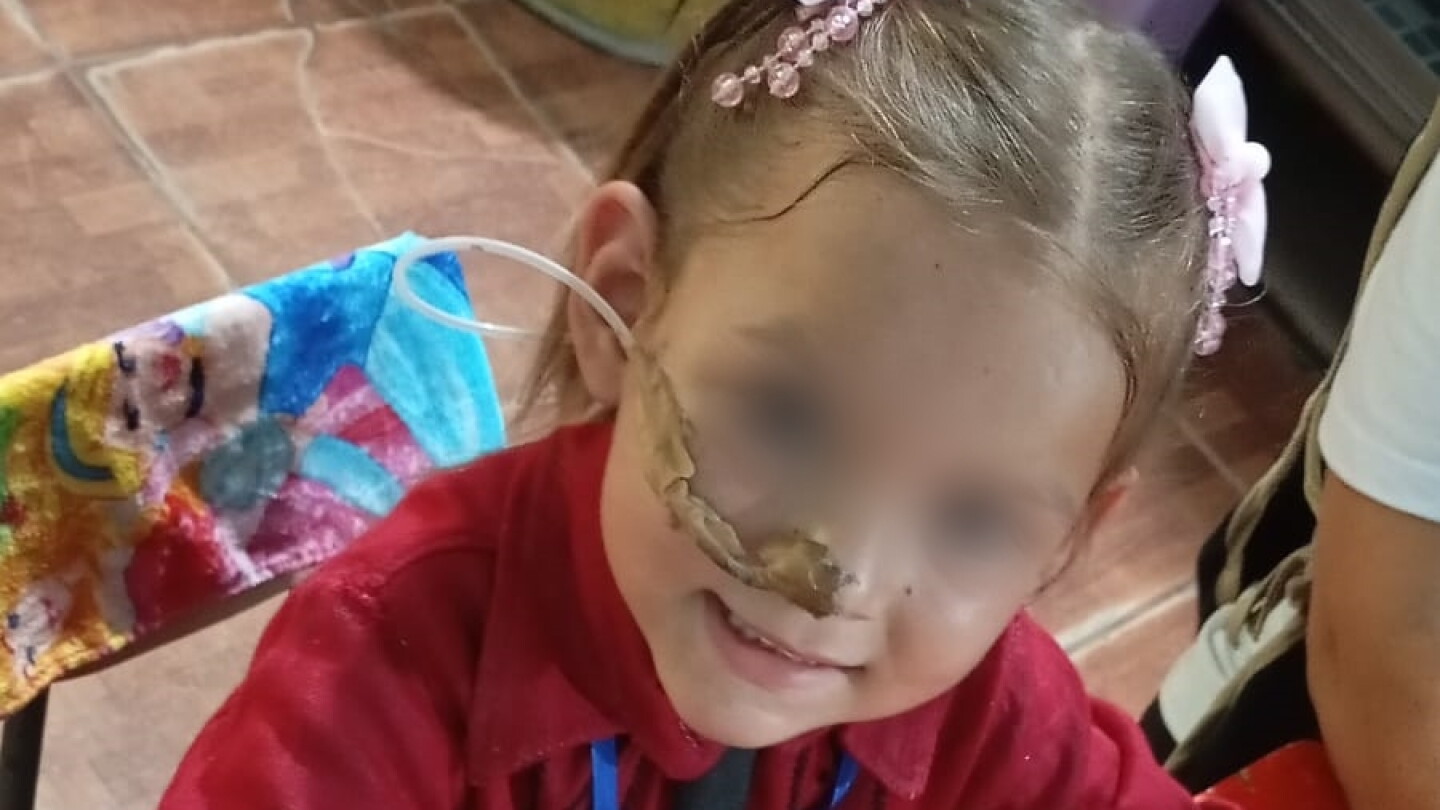 Paloma, uma menina de 5 anos com doença de Hirschsprung, necessita de apoio comunitário